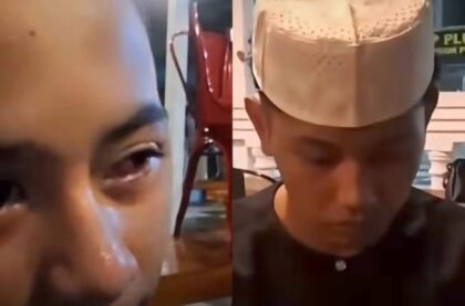 Santri di Banyuasin Diduga Dianiaya Ustaz, Mata Lebam Viral dan Dilaporkan ke Polisi